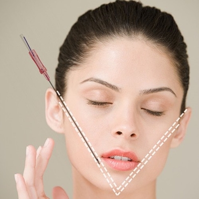 Linha Nonsurgical 18G 100mm da roda denteada do levantamento de cara da linha de PDO para o levantamento de cara imediato